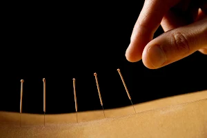 HealthWorks Physiotherapy Massage Therapy & Acupuncture image