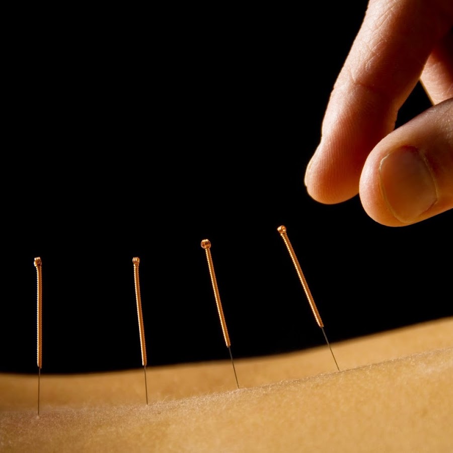 HealthWorks Physiotherapy Massage Therapy & Acupuncture