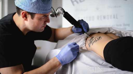 Renewal Tattoo Removal