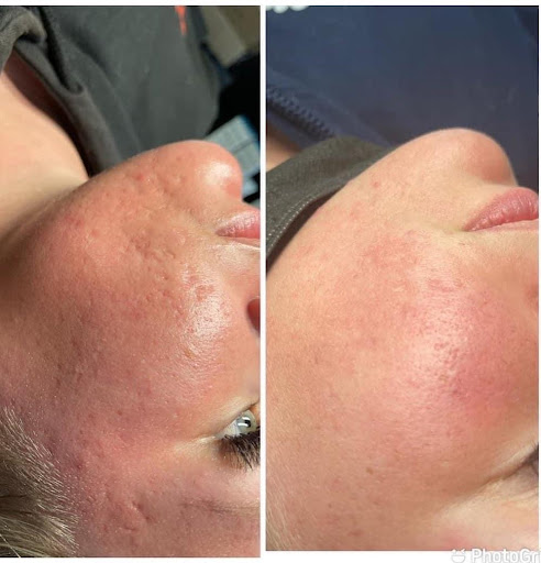 Explore small semicolon tattoo ideas, creative tattoo ideas in Savannah, available at Haute Brows. Cosmetic Tattoo