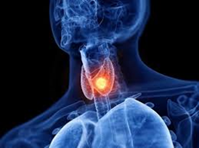 NaturO'pur - Spécialisée en Hypothyroïdie et Hashimoto - Qualité de l'air intérieur à Reims à Reims