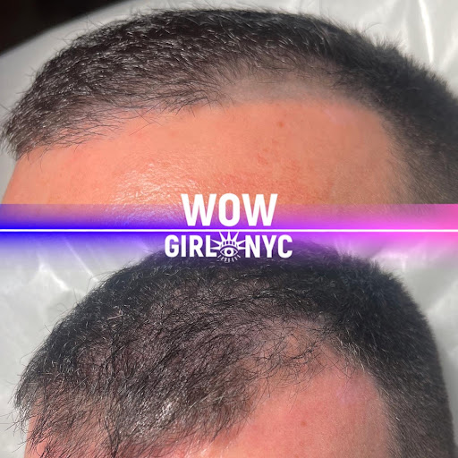 Explore back of neck tattoo cover up ideas, creative tattoo ideas in New York, available at WOW LASER NYC Tattoo removal in New York