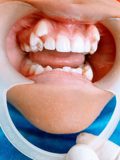 Oprem Dental Clínica odontológica especializada / Dra. Maria Molina / Dra. Karen Bustos