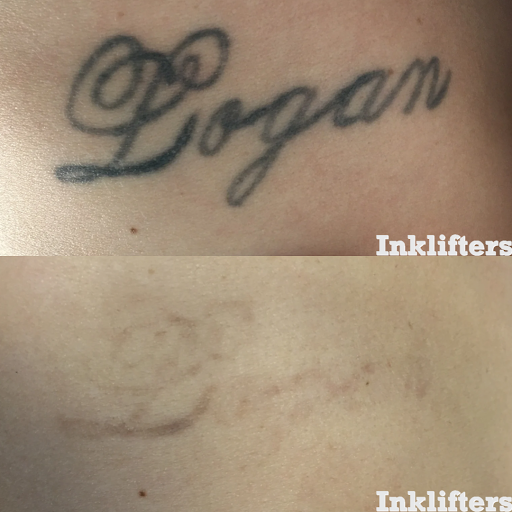 Explore tattoo ideas sleeve girl, creative tattoo ideas in Pleasant Grove, available at Inklifters Tattoo Removal