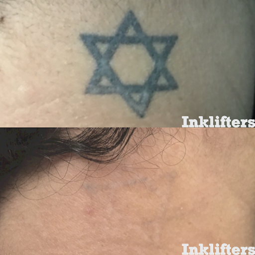 Explore black lab tattoo ideas, creative tattoo ideas in Pleasant Grove, available at Inklifters Tattoo Removal