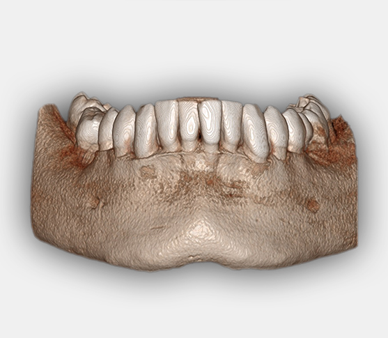Opinii despre DentaVis 3 - Radiologie Dentara în <nil> - Dentist