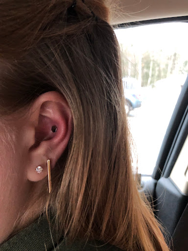 Explore tattoo over scar ideas, creative tattoo ideas in Sanford, available at Venom Ink Tattoo