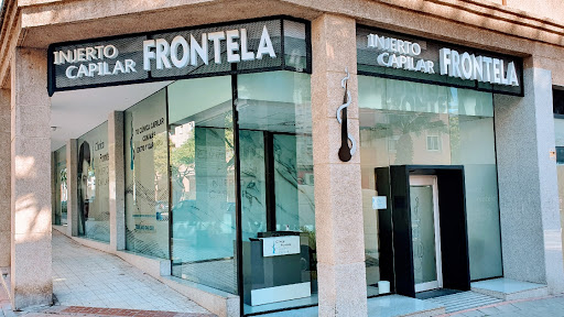 Injerto capilar Málaga - Clínica FRONTELA.🥇Tratamientos Prp y mesoterapia