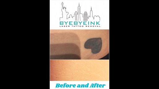Explore hand mens tattoo ideas, creative tattoo ideas in Middle Village, available at Bye Bye Ink Laser Tattoo Removal