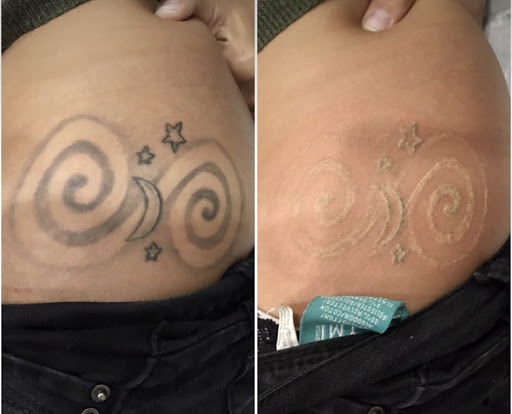 Explore mha tattoo ideas, creative tattoo ideas in Las Vegas, available at Black Inc Laser Tattoo & Hair Removal