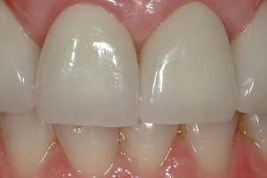 OB1 Dental | Dr. Oz image