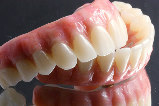 Dental implants periodontist Torrance
