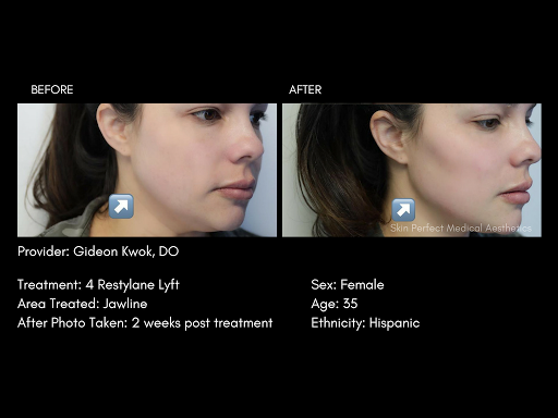 Skin Perfect Medical Aesthetics - Rancho Cucamonga image