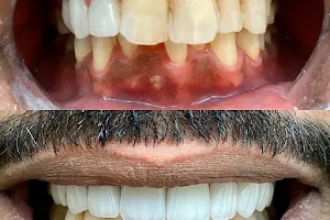 Al Saad Dental Clinic عيادة السعد لطب الأسنان image