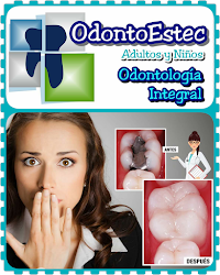 Odontoestec