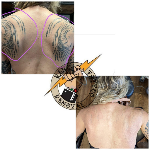 Explore kansas city tattoo ideas, creative tattoo ideas in Reno, available at Reno Tattoo Removal