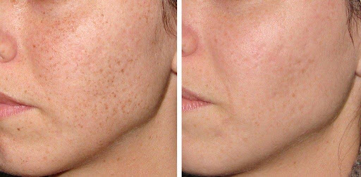 Beach Cities Vein and Laser Center image