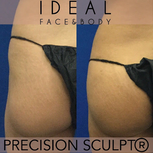 Ideal Face & Body image