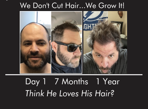 Honest Hair Restoration