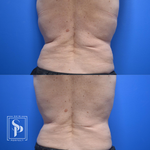 Explore grandson tattoo ideas, creative tattoo ideas in Whittier, available at Skin Perfect Medical Aesthetics