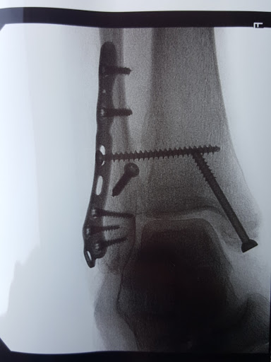 Orange County Podiatry image