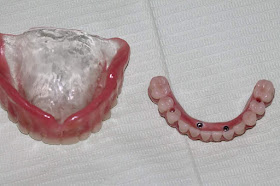 Dorian Hugo implantologia oral y estética dental