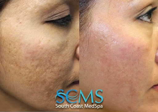 South Coast MedSpa image