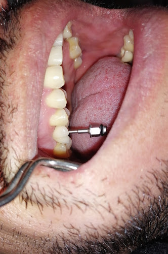 Opiniones de Dr. Gabriel Medina, Odontólogo - Consultorio Dental - Carillas e Implantes Dentales en Cusco - Dentista