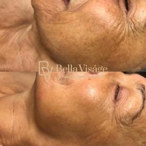 Explore meaningful father and daughter crps tattoo ideas, creative tattoo ideas in Lakeland, available at Bella Visge Medical & Aesthetic Rejuvenation