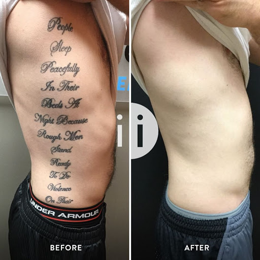 Find feminine skull tattoo ideas for your next unique tattoo in Jacksonville at Removery Tattoo Removal & Fading