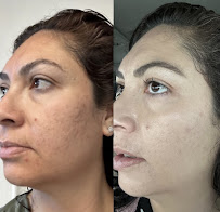 Ale Beauty Studio Skin & Makeup - Photo 7 - Car repair in Riverside, CA, Riverside