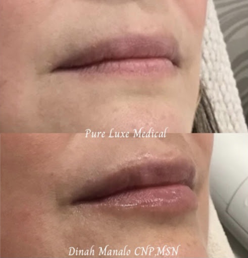 Pure Luxe Medical - El Segundo image