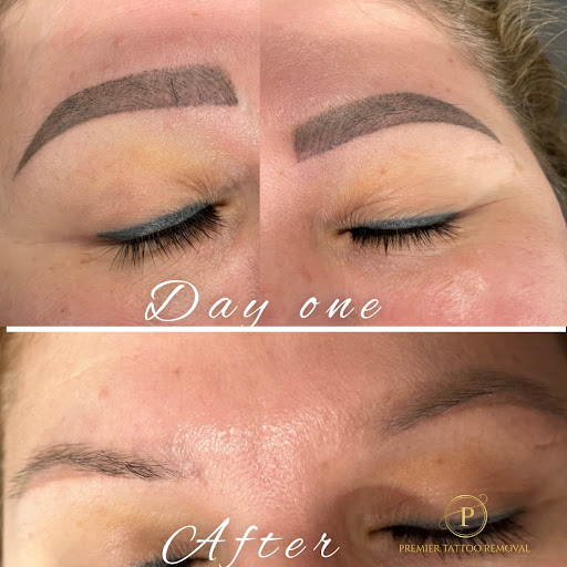 Explore igy6 tattoo ideas, creative tattoo ideas in Mckinney, available at Premier Tattoo Removal