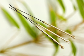 Silke Akupunktur