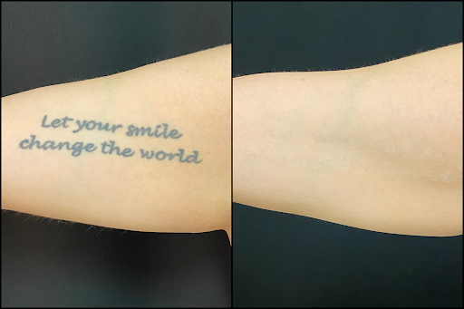 Explore tattoo ideas for 3 daughters, creative tattoo ideas in Brookfield, available at Milwaukee Laser & Body Aesthetics