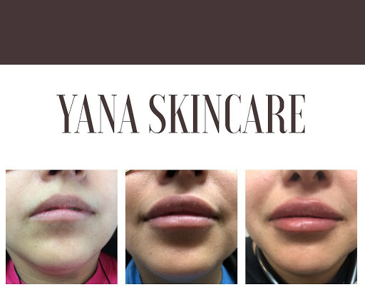 Laser Hair Removal Service «Yana Skin Care», reviews and photos, 3101 Richmond Ave #200, Houston, TX 77098, USA