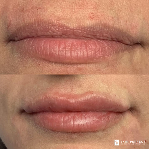 Explore filler sleeve tattoo ideas, creative tattoo ideas in Whittier, available at Skin Perfect Medical Aesthetics