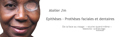 Atelier J'm Epithèse | prothèse maxillo faciale | Prothèse mammaire externe | Julien Montenero à Paris