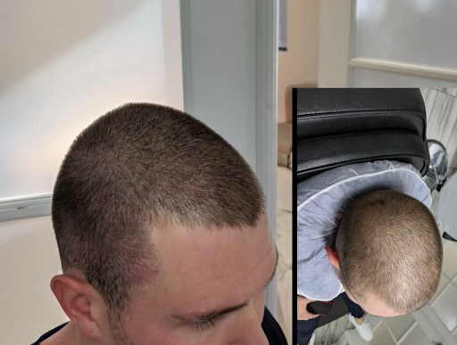 Explore guardian angel tattoo ideas, creative tattoo ideas in Roseville, available at NuHair Ink. Scalp MicroPigmentation & Aesthetic Clinic of Sacramento