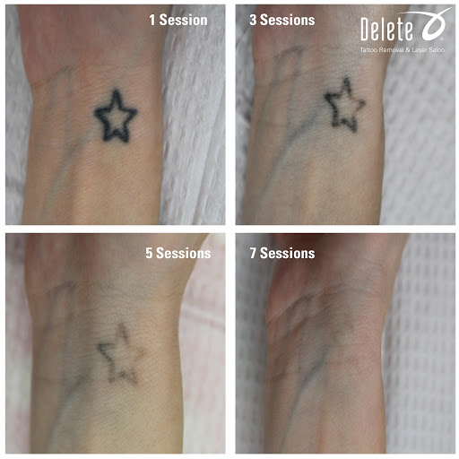 Explore jojo's bizarre adventure tattoo ideas, creative tattoo ideas in Phoenix, available at Removery Tattoo Removal & Fading