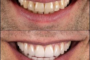 Стоматологія Orange Clinic Вініри, імпланти, керамічна реставрація, брекети Усі види стоматологічних послуг в Чернівцях image