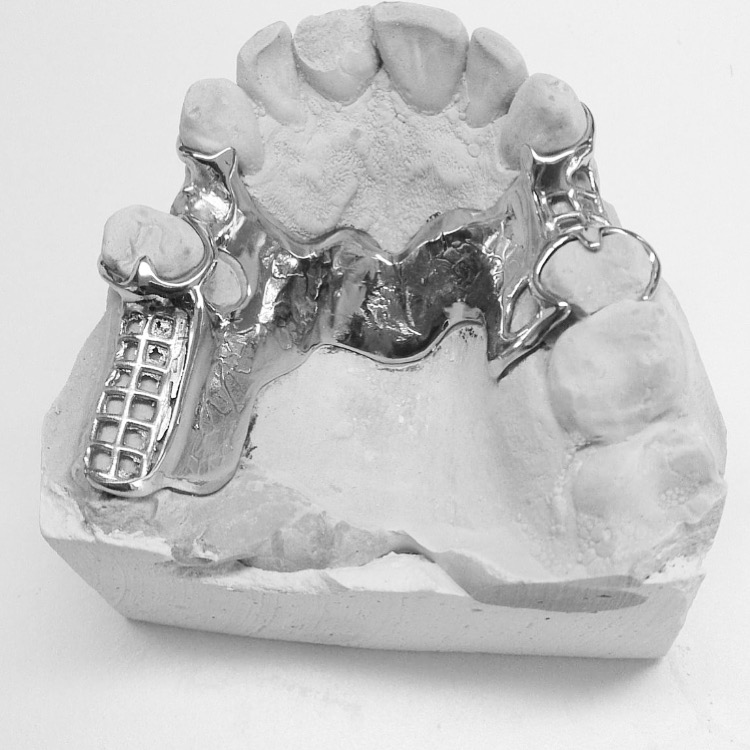 Protesis Dental Molina