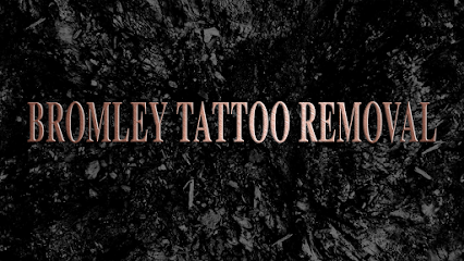 Bromley Tattoo Removal