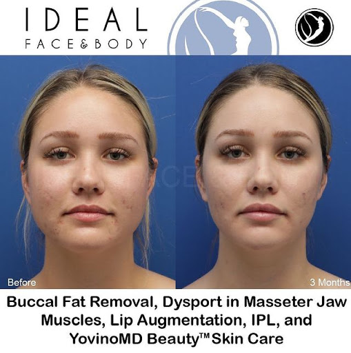 Ideal Face & Body image