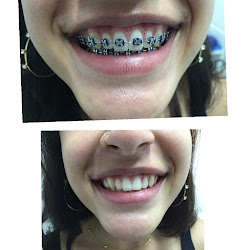 Centro odontologico sorriso BH | Implante | Dentista | ortodontia | Aparelho odontológico | Prótese Dentária