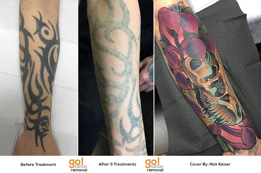 Explore gay couple tattoo ideas, creative tattoo ideas in Allentown, available at Removery Tattoo Removal & Fading
