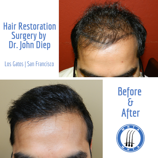 Hair Replacement Service «Medical Hair Transplant & Aesthetics», reviews and photos, 490 Post St #1701, San Francisco, CA 94102, USA