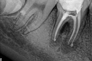 Chandra Dental clinic and Orthdodontic Centre image