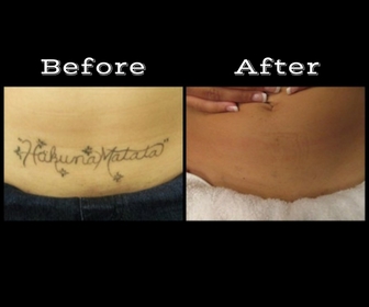 Explore alice in wonderland tattoo ideas, creative tattoo ideas in Longview, available at Vanish Laser Aesthetics