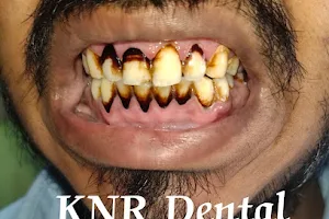 KNR Multi speciality Dental Hospital and Implant centre image